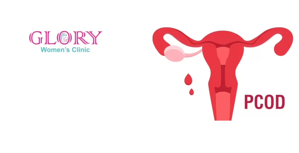 Learn about PCOD, its causes, symptoms, and effective treatment options. Get expert care from a Gynecologist in Ravet for PCOD